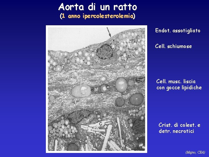 Aorta di un ratto (1 anno ipercolesterolemia) Endot. assotigliato Cell. schiumose Cell. musc. liscia