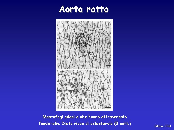 Aorta ratto Macrofagi adesi e che hanno attraversato l’endotelio. Dieta ricca di colesterolo (8