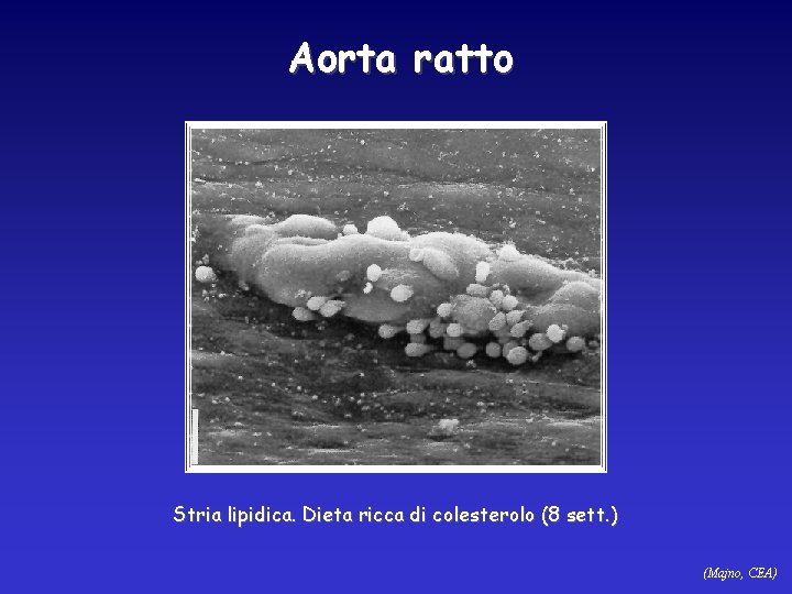 Aorta ratto Stria lipidica. Dieta ricca di colesterolo (8 sett. ) (Majno, CEA) 