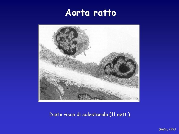 Aorta ratto Dieta ricca di colesterolo (11 sett. ) (Majno, CEA) 