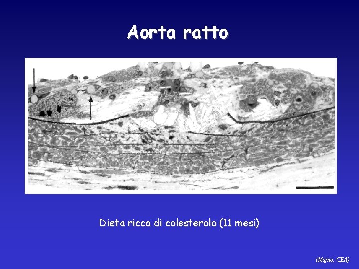 Aorta ratto Dieta ricca di colesterolo (11 mesi) (Majno, CEA) 