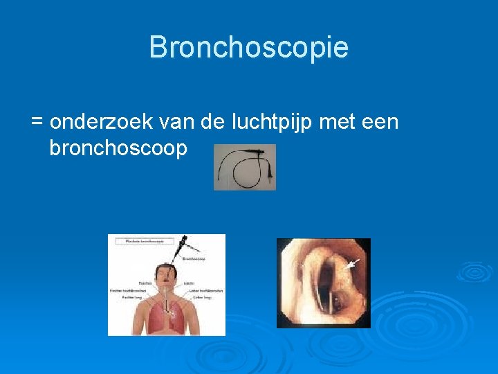 Bronchoscopie = onderzoek van de luchtpijp met een bronchoscoop 