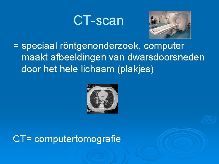 CT-scan = speciaal röntgenonderzoek, computer maakt afbeeldingen van dwarsdoorsneden door het hele lichaam (plakjes)