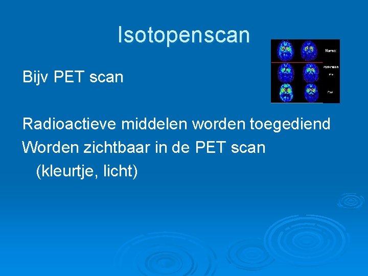 Isotopenscan Bijv PET scan Radioactieve middelen worden toegediend Worden zichtbaar in de PET scan