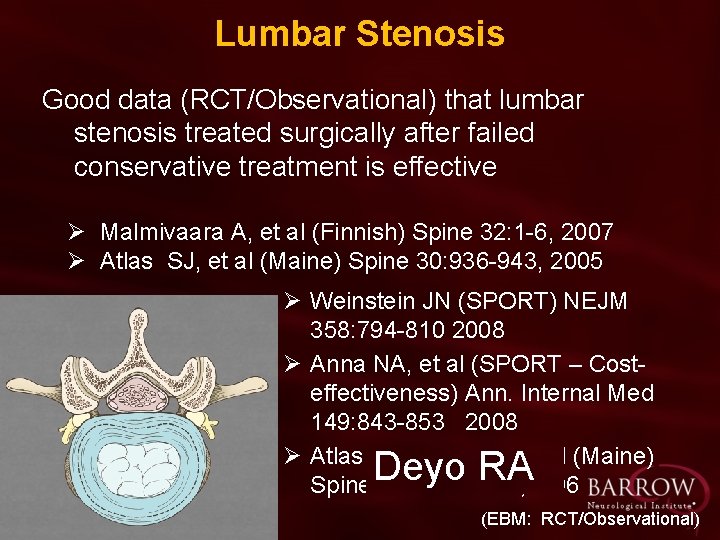 Lumbar Stenosis Good data (RCT/Observational) that lumbar stenosis treated surgically after failed conservative treatment