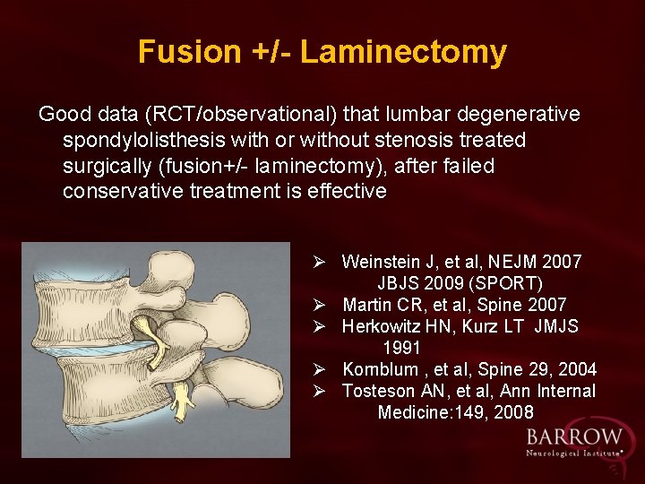 Fusion +/- Laminectomy Good data (RCT/observational) that lumbar degenerative spondylolisthesis with or without stenosis