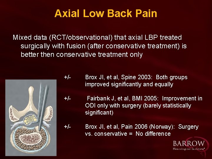 Axial Low Back Pain Mixed data (RCT/observational) that axial LBP treated surgically with fusion
