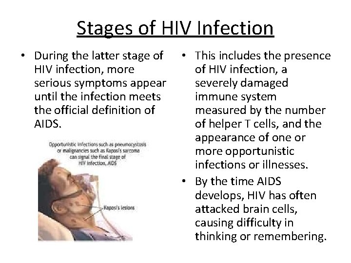 Stages of HIV Infection • During the latter stage of HIV infection, more serious