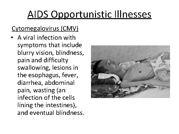 AIDS Opportunistic Illnesses Cytomegalovirus (CMV) • A viral infection with symptoms that include blurry