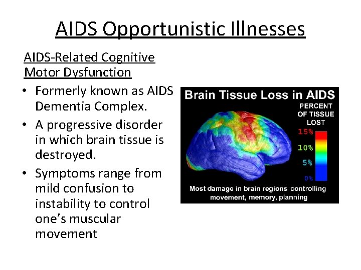 AIDS Opportunistic Illnesses AIDS-Related Cognitive Motor Dysfunction • Formerly known as AIDS Dementia Complex.