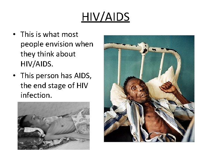 HIV/AIDS • This is what most people envision when they think about HIV/AIDS. •