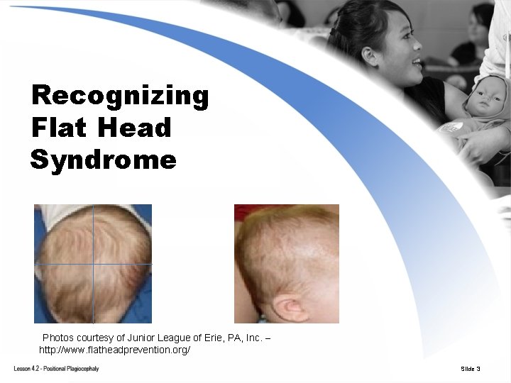 Recognizing Flat Head Syndrome Photos courtesy of Junior League of Erie, PA, Inc. –