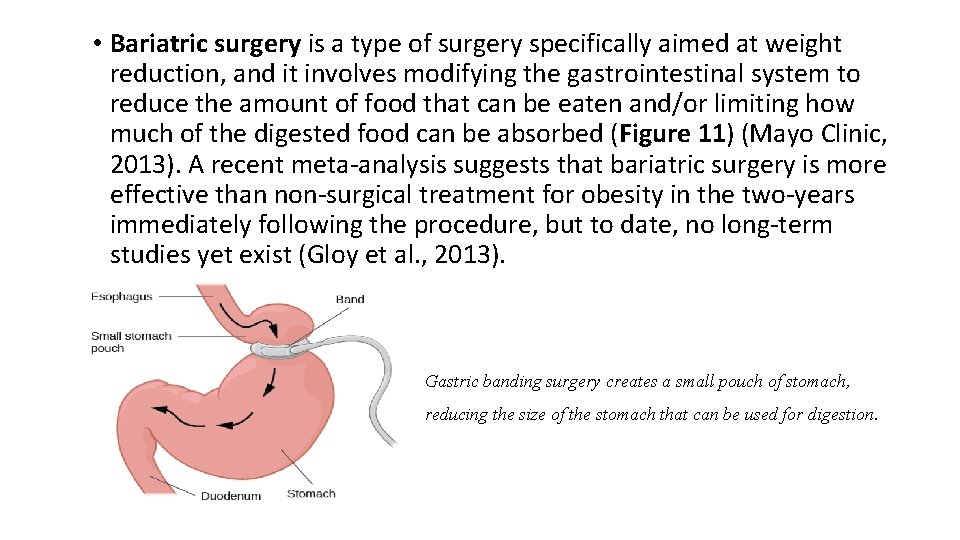  • Bariatric surgery is a type of surgery specifically aimed at weight reduction,