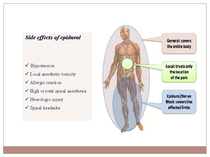 Side effects of epidural ü Hypotension ü Local anesthetic toxicity ü Allergic reaction ü
