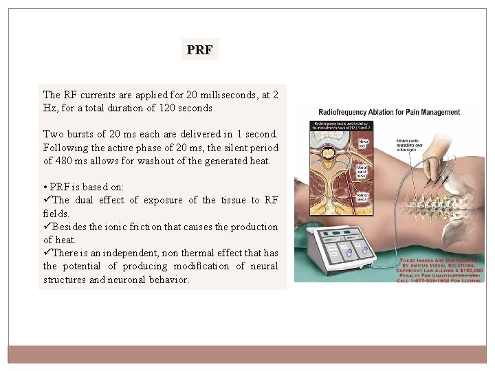 PRF The RF currents are applied for 20 milliseconds, at 2 Hz, for a