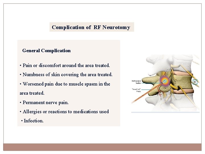 Complication of RF Neurotomy General Complication • Pain or discomfort around the area treated.