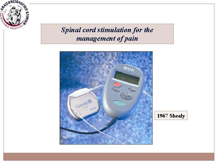Spinal cord stimulation for the management of pain 1967 Shealy 