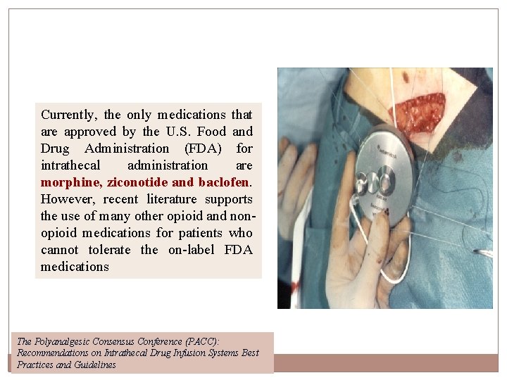 Currently, the only medications that are approved by the U. S. Food and Drug