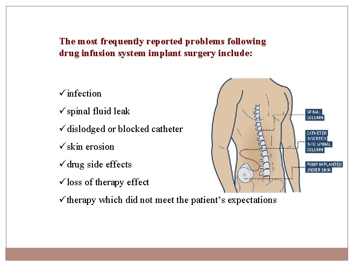 The most frequently reported problems following drug infusion system implant surgery include: üinfection üspinal