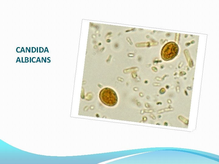 CANDIDA ALBICANS 