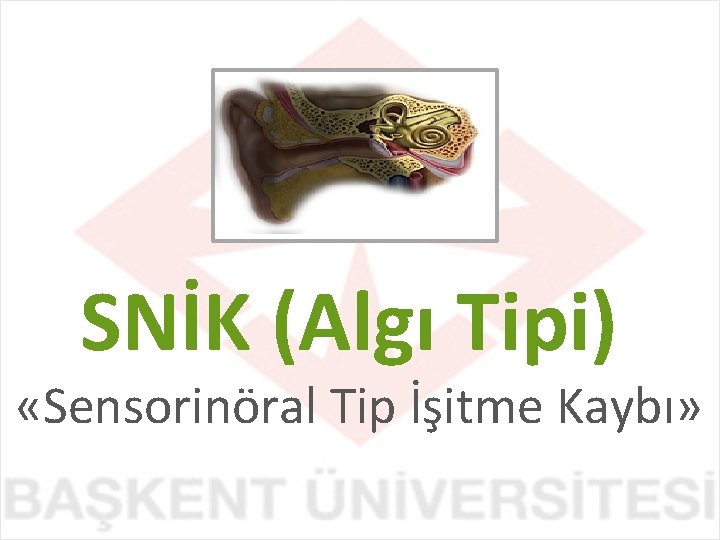 SNİK (Algı Tipi) «Sensorinöral Tip İşitme Kaybı» 