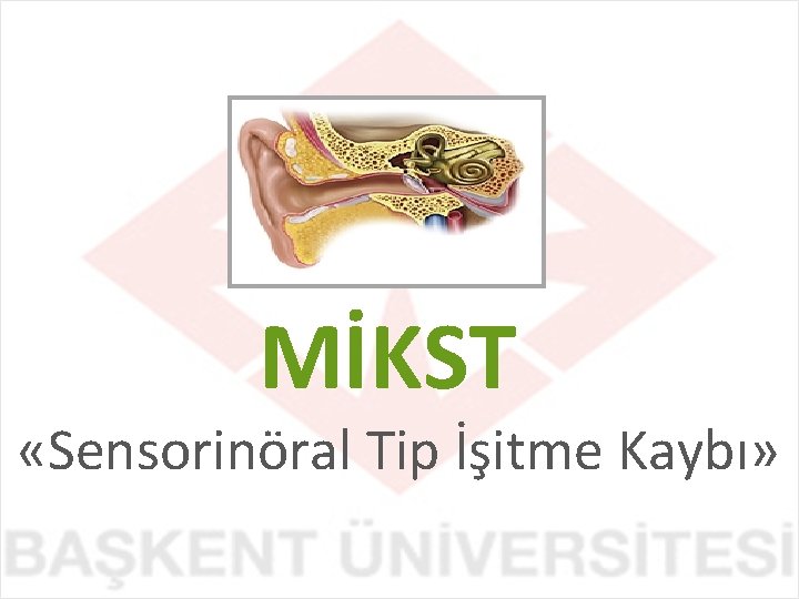 MİKST «Sensorinöral Tip İşitme Kaybı» 