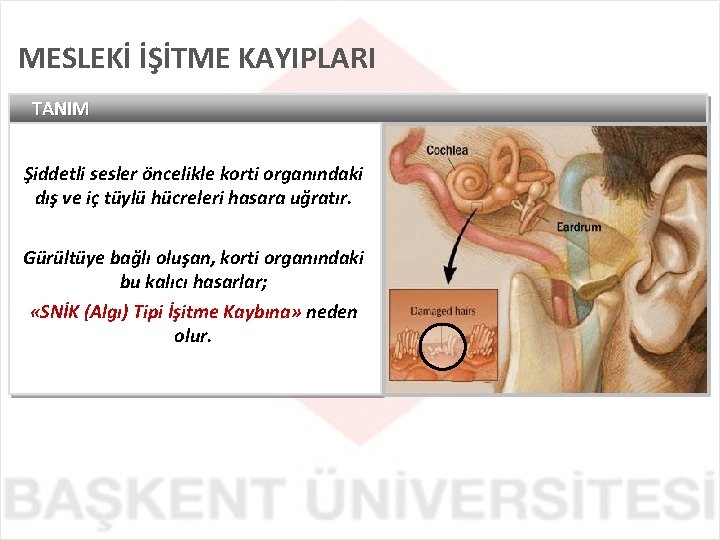 MESLEKİ İŞİTME KAYIPLARI TANIM Şiddetli sesler öncelikle korti organındaki dış ve iç tüylü hücreleri