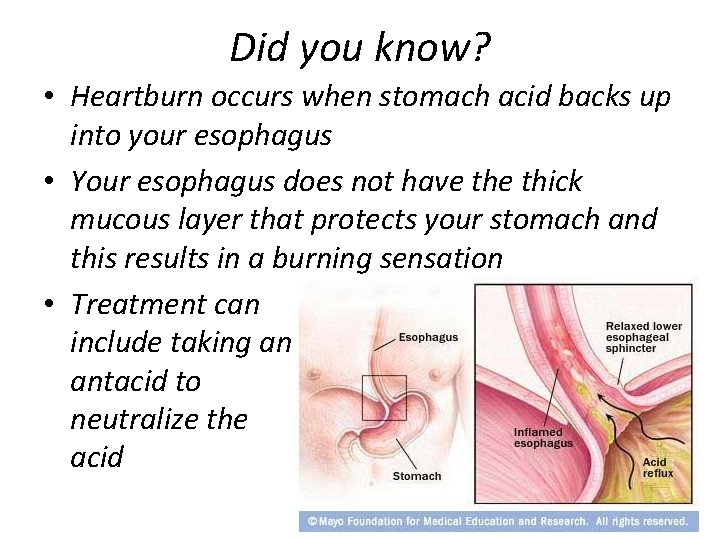 Did you know? • Heartburn occurs when stomach acid backs up into your esophagus