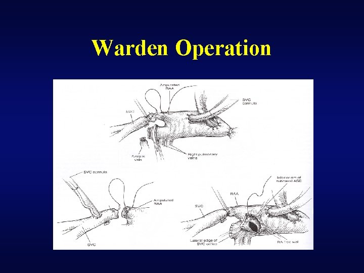 Warden Operation 