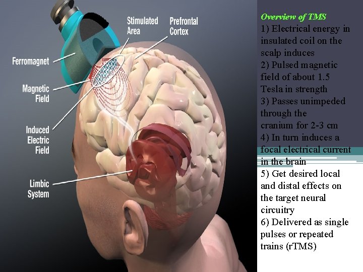 Overview of TMS 1) Electrical energy in insulated coil on the scalp induces 2)