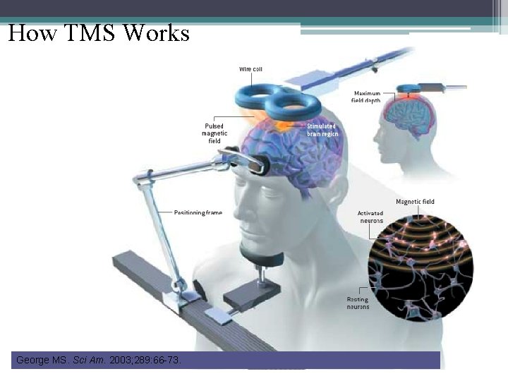 How TMS Works George MS. Sci Am. 2003; 289: 66 -73. 