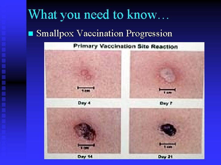 What you need to know… n Smallpox Vaccination Progression 