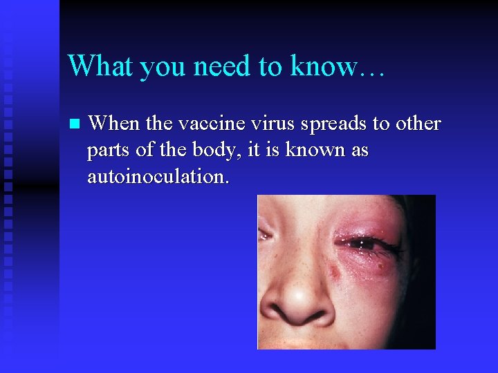 What you need to know… n When the vaccine virus spreads to other parts