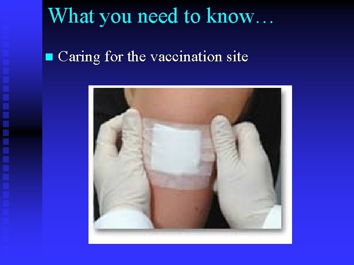 What you need to know… n Caring for the vaccination site 