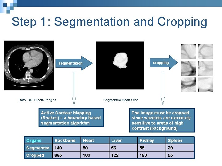 Step 1: Segmentation and Cropping cropping segmentation Data: 340 Dicom Images Segmented Heart Slice