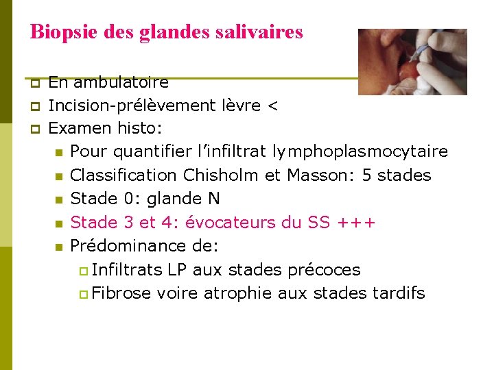 Biopsie des glandes salivaires p p p En ambulatoire Incision-prélèvement lèvre < Examen histo: