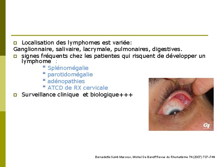 Localisation des lymphomes est variée: Ganglionnaire, salivaire, lacrymale, pulmonaires, digestives. p signes fréquents chez