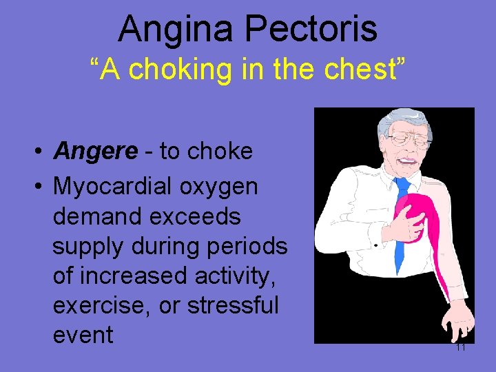 Angina Pectoris “A choking in the chest” • Angere - to choke • Myocardial