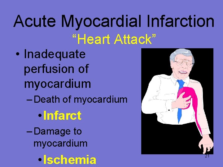 Acute Myocardial Infarction “Heart Attack” • Inadequate perfusion of myocardium – Death of myocardium