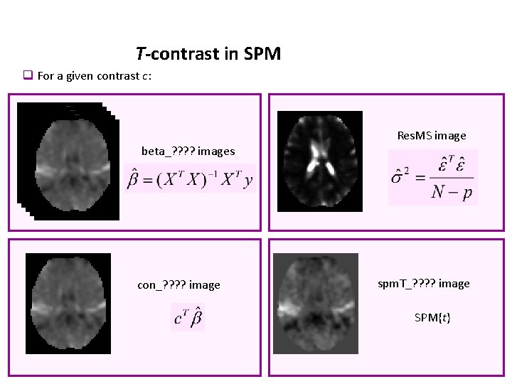 T-contrast in SPM q For a given contrast c: Res. MS image beta_? ?