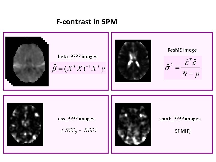 F-contrast in SPM Res. MS image beta_? ? images ess_? ? images ( RSS
