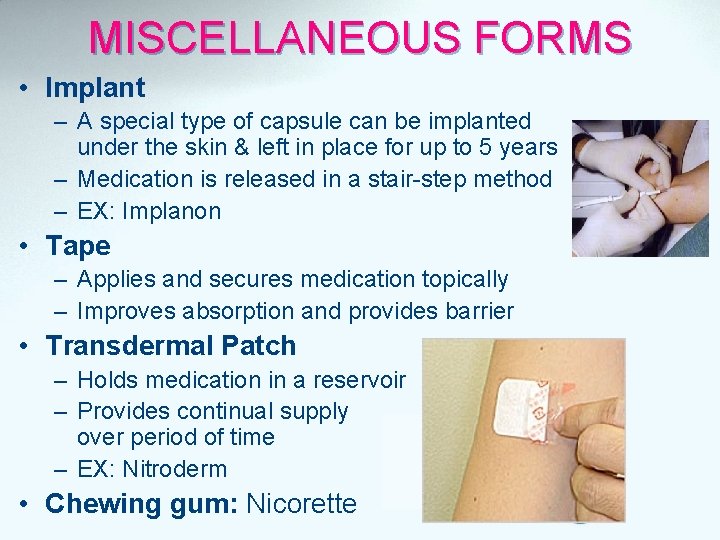 MISCELLANEOUS FORMS • Implant – A special type of capsule can be implanted under