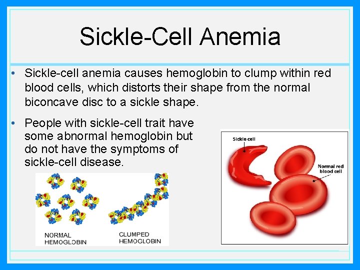 Sickle-Cell Anemia • Sickle-cell anemia causes hemoglobin to clump within red blood cells, which