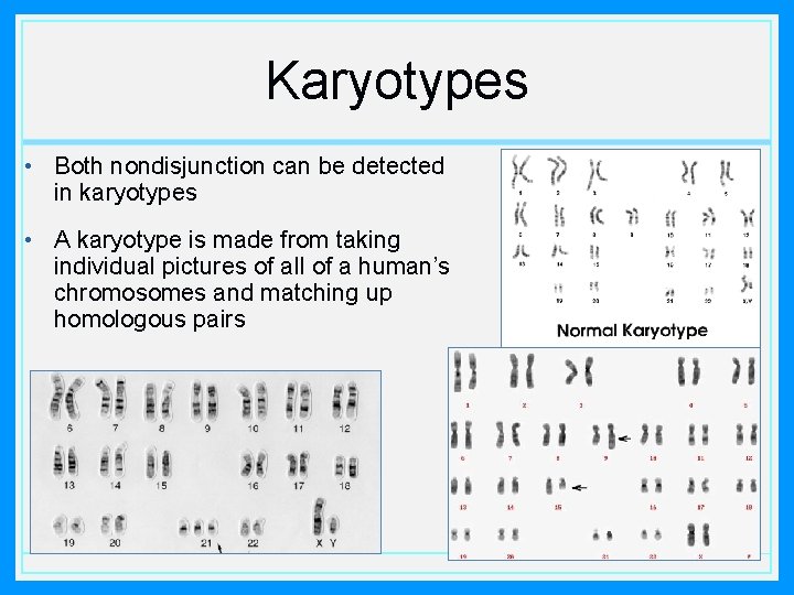 Karyotypes • Both nondisjunction can be detected in karyotypes • A karyotype is made