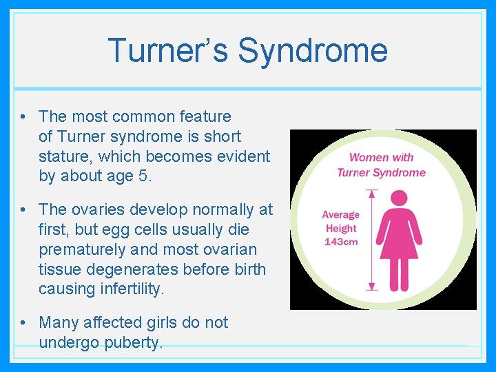 Turner’s Syndrome • The most common feature of Turner syndrome is short stature, which