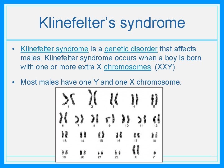 Klinefelter’s syndrome • Klinefelter syndrome is a genetic disorder that affects males. Klinefelter syndrome