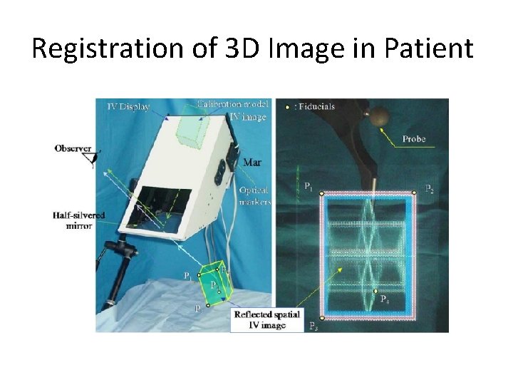 Registration of 3 D Image in Patient 