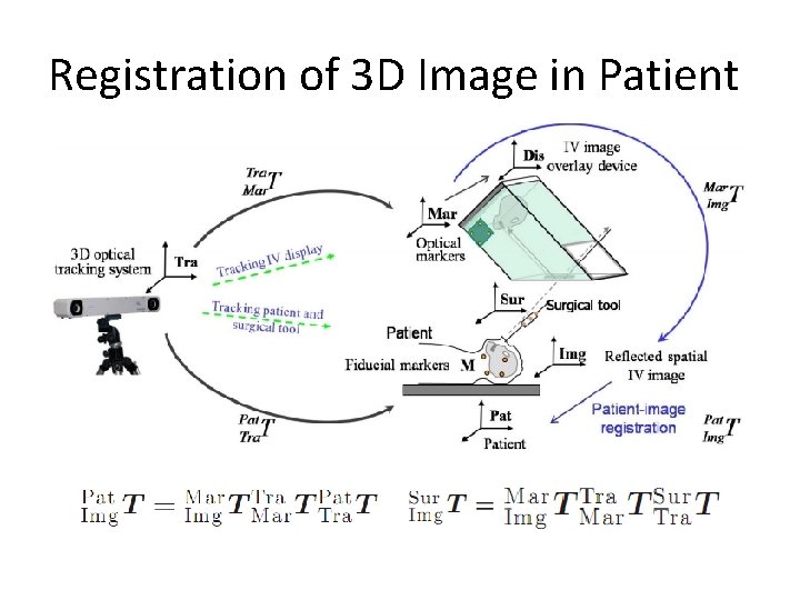 Registration of 3 D Image in Patient 