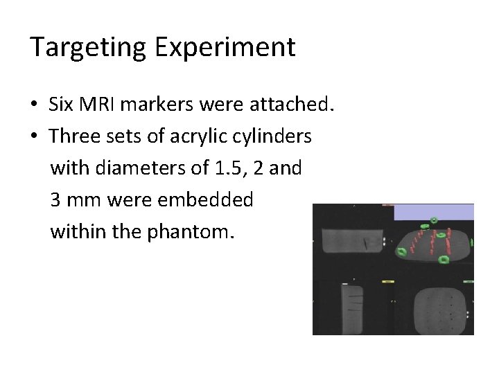 Targeting Experiment • Six MRI markers were attached. • Three sets of acrylic cylinders