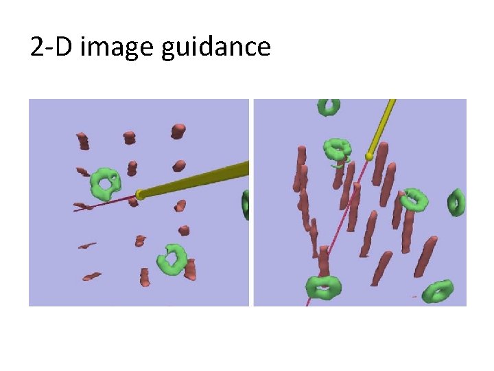 2 -D image guidance 